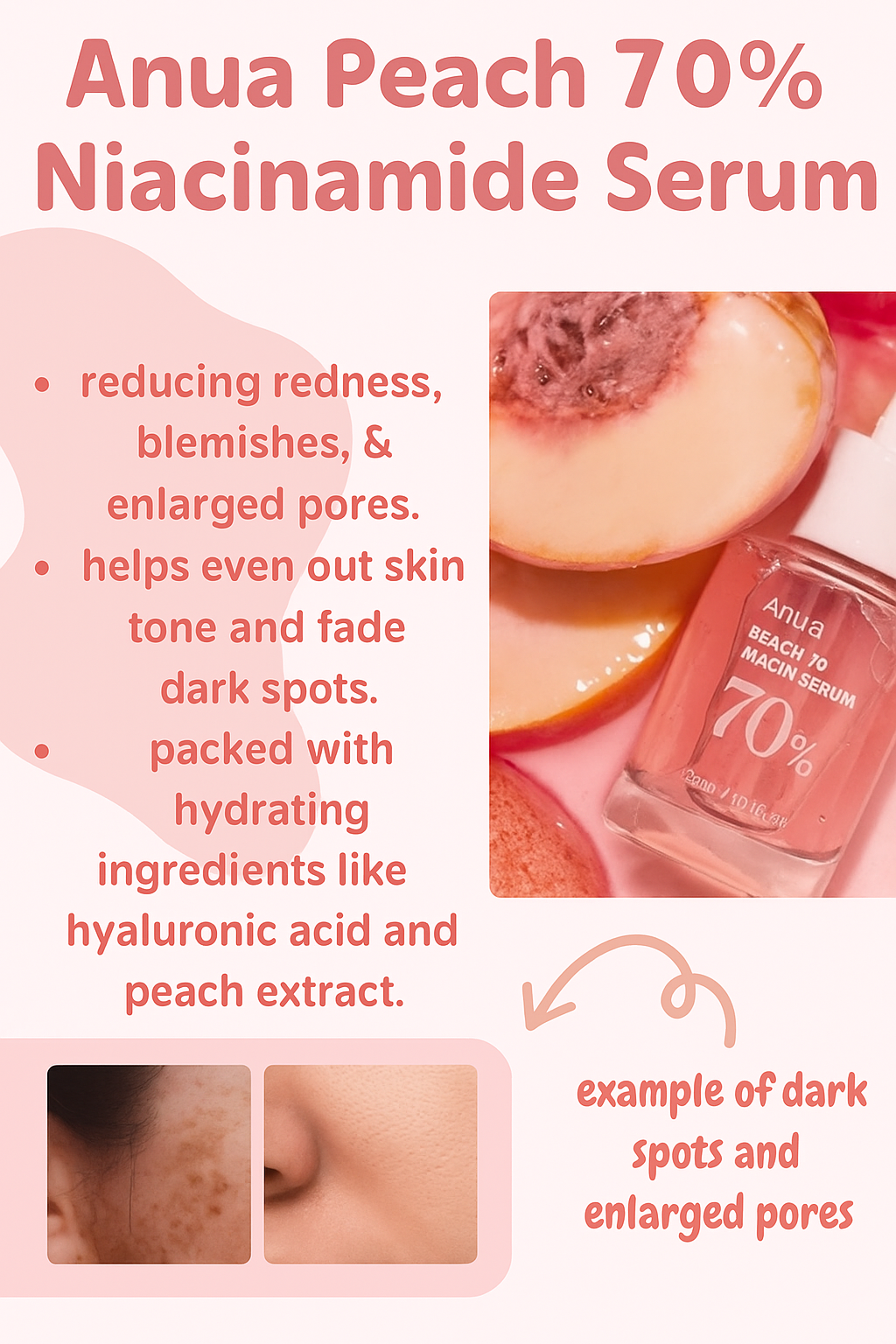 Anua Peach 70 Niacin Serum
